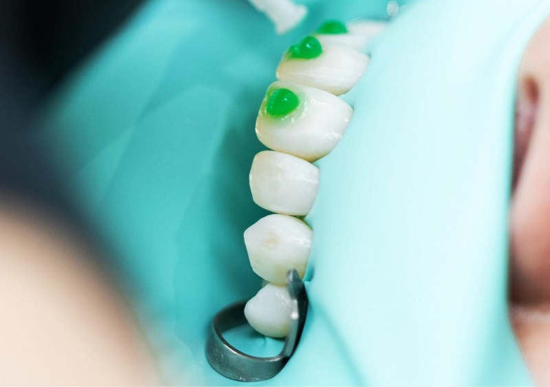 Dr. Dt. Fatih Rasim,Estetik Diş Hekimliği, Diş Eti Hastalıkları Tedavisi, Protetik Diş Hekimliği Tedavileri, Ortodontik Tedaviler, Cerrahi Tedaviler, Çene Eklemi Rahatsızlıkları ve Tedavileri, Çocuk Diş Hekimliği ve Koruyucu Uygulamaları, Dişeti Periodontal Hastalıklar ve Tedavileri