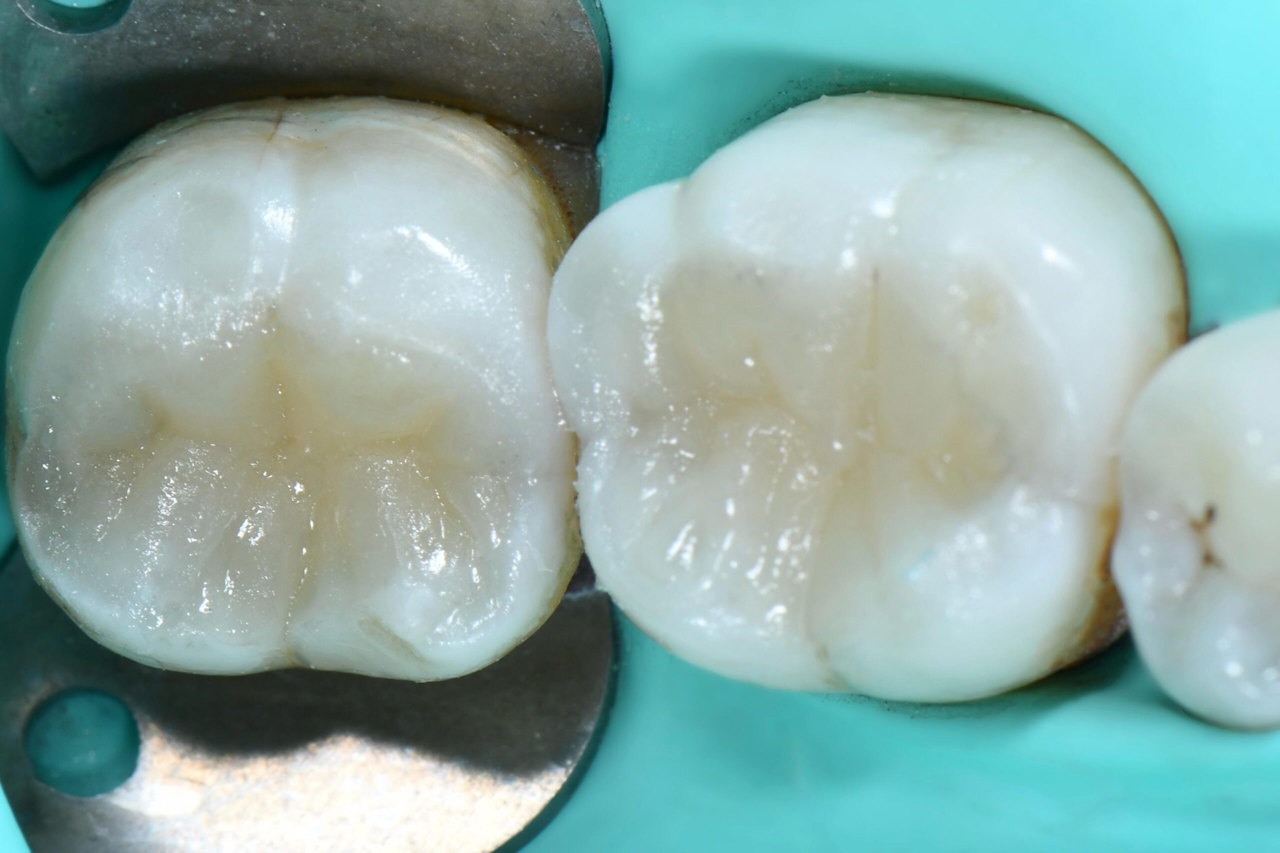 Dr. Dt. Fatih Rasim,Estetik Diş Hekimliği, Diş Eti Hastalıkları Tedavisi, Protetik Diş Hekimliği Tedavileri, Ortodontik Tedaviler, Cerrahi Tedaviler, Çene Eklemi Rahatsızlıkları ve Tedavileri, Çocuk Diş Hekimliği ve Koruyucu Uygulamaları, Dişeti Periodontal Hastalıklar ve Tedavileri